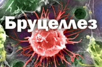 бруцеллез