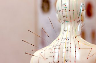 иглоукалывание